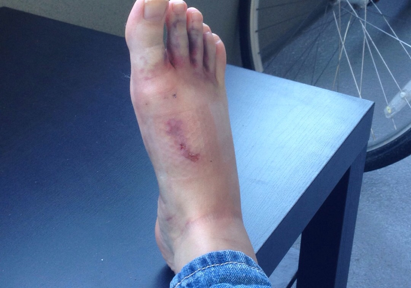 Illustration for article titled The Tale of Zombie!Foot